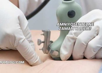 Amniyosentez Ne Zaman Yapılır?