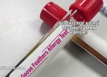 Bebeklerde Alerji Testi Ne Zaman Yapılır?