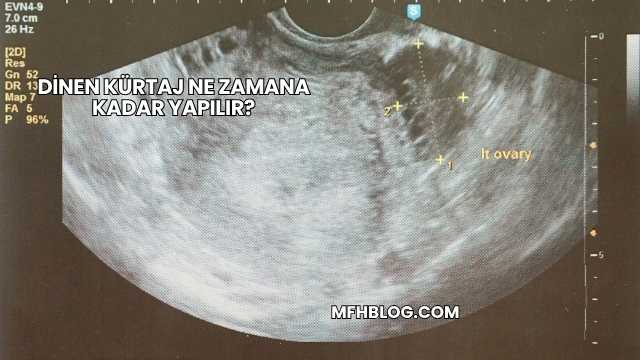 Dinen Kürtaj Ne Zamana Kadar Yapılır?