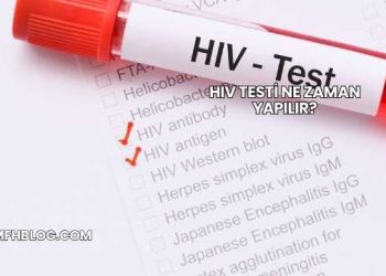 HIV Testi Ne Zaman Yapılır?