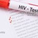 HIV Testi Ne Zaman Yapılır?