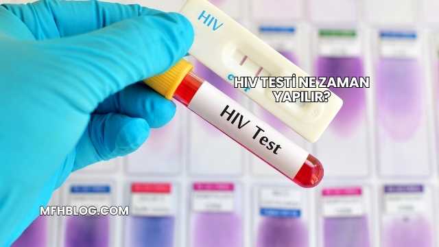 HIV Testi Ne Zaman Yapılır?