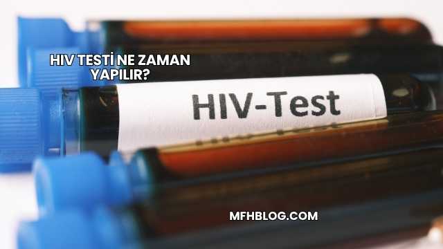 HIV Testi Ne Zaman Yapılır?