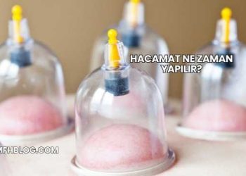 Hacamat Ne Zaman Yapılır?