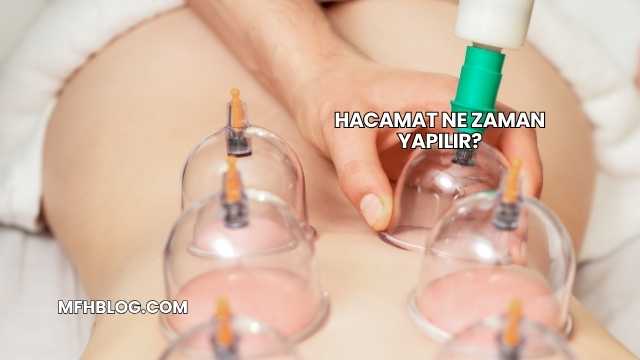 Hacamat Ne Zaman Yapılır?