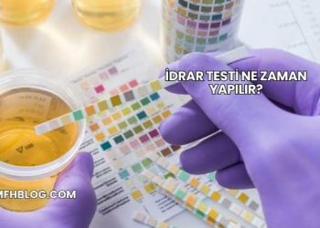 İdrar Testi Ne Zaman Yapılır?