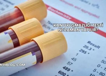 Kan Uyuşmazlığı Testi Ne Zaman Yapılır?