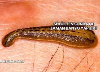 Sülükten Sonra Ne Zaman Banyo Yapılır?