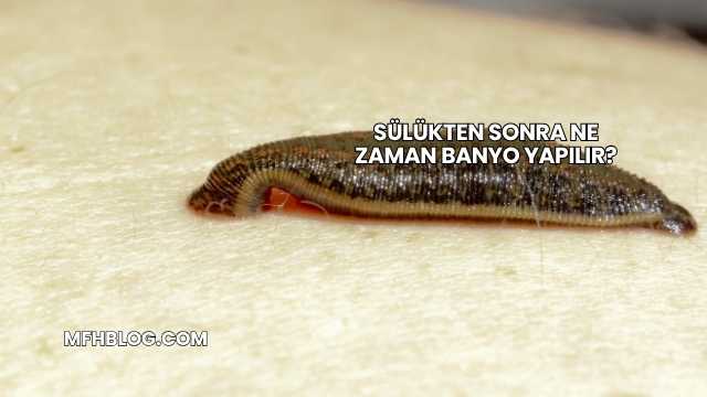 Sülükten Sonra Ne Zaman Banyo Yapılır?