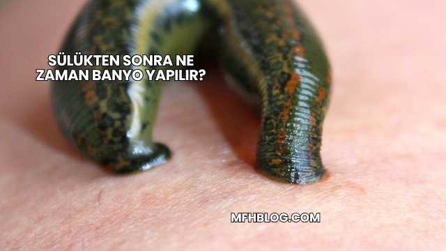 Sülükten Sonra Ne Zaman Banyo Yapılır?
