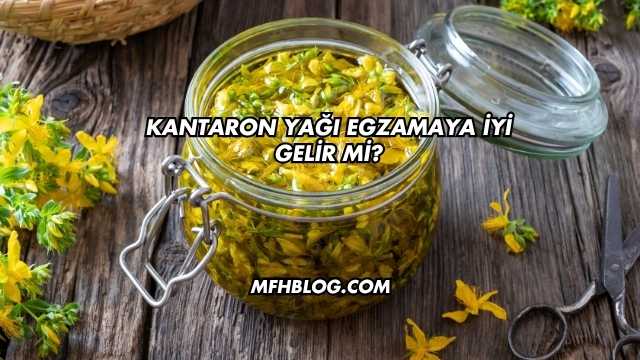 Kantaron Yağı Egzamaya İyi Gelir mi?