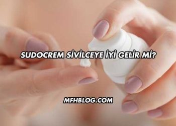 Sudocrem Sivilceye İyi Gelir mi?