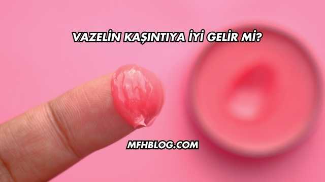 Vazelin Kaşıntıya İyi Gelir mi?