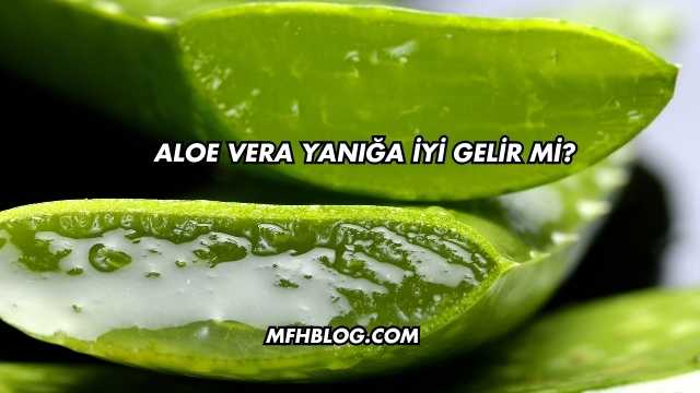 Aloe Vera Yanığa İyi Gelir mi?