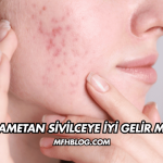 Hametan Sivilceye İyi Gelir mi?