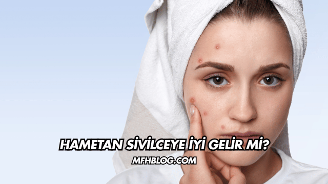 Hametan Sivilceye İyi Gelir mi?