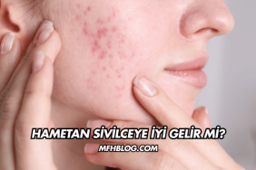 Hametan Sivilceye İyi Gelir mi?